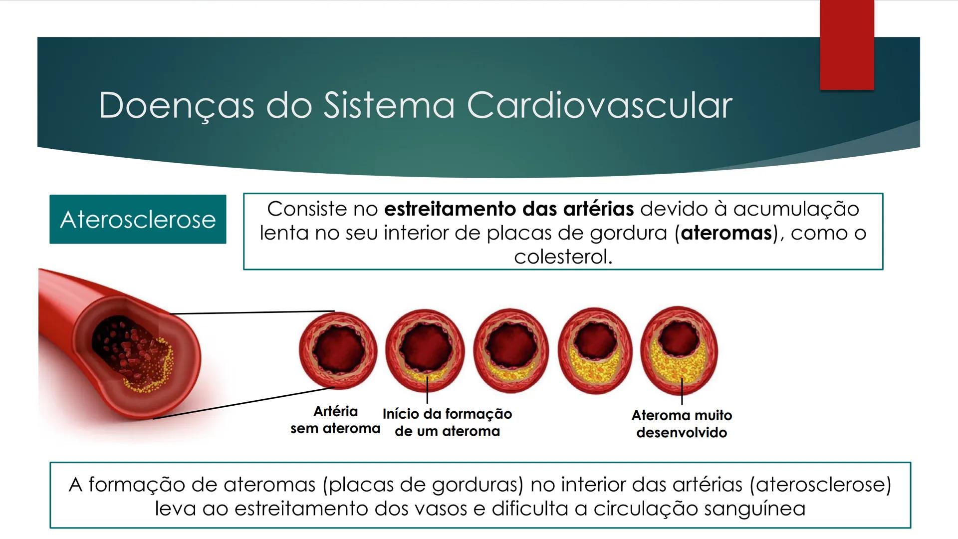 CIÊNCIAS NATURAIS | 9.° ANO
SISTEMA
CARDIOVASCULAR
VIVER MELHOR NA TERRA
ORGANISMO HUMANO EM
EQUILÍBRIO
Aprendizagem Essencial
Identific