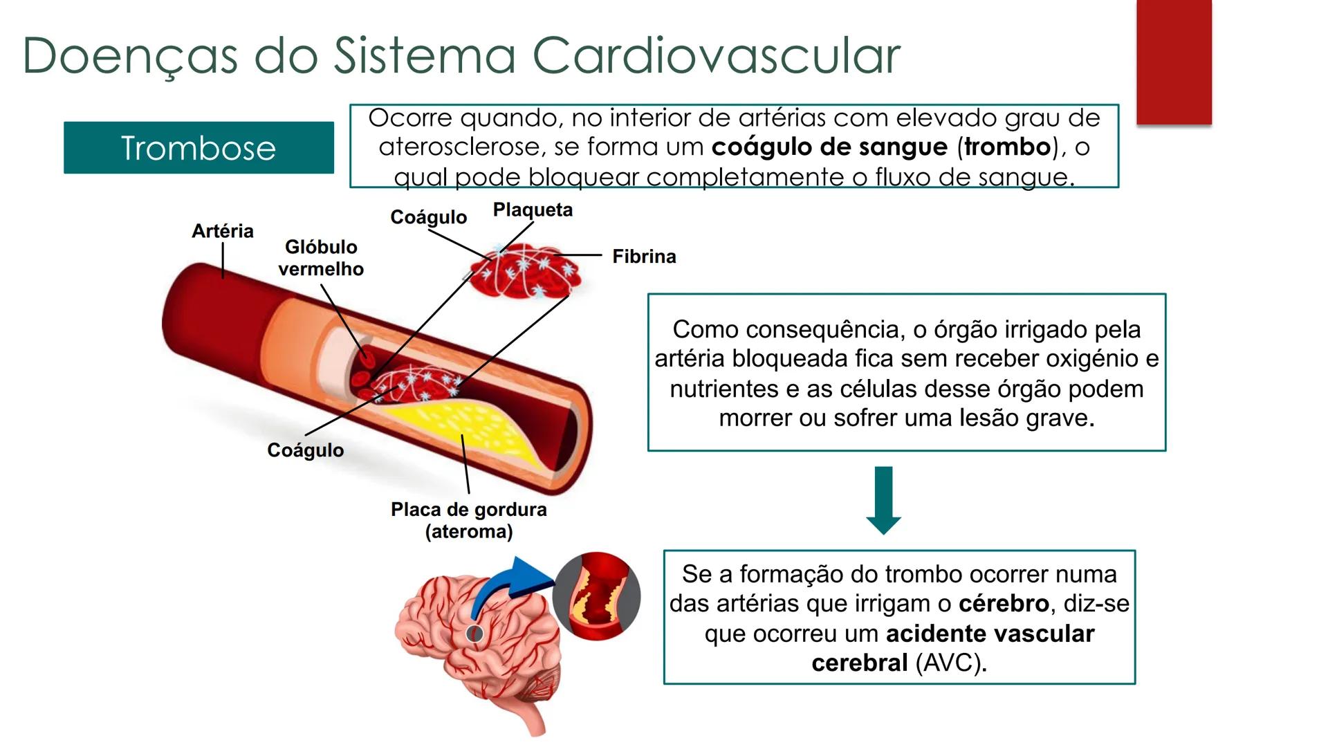 CIÊNCIAS NATURAIS | 9.° ANO
SISTEMA
CARDIOVASCULAR
VIVER MELHOR NA TERRA
ORGANISMO HUMANO EM
EQUILÍBRIO
Aprendizagem Essencial
Identific