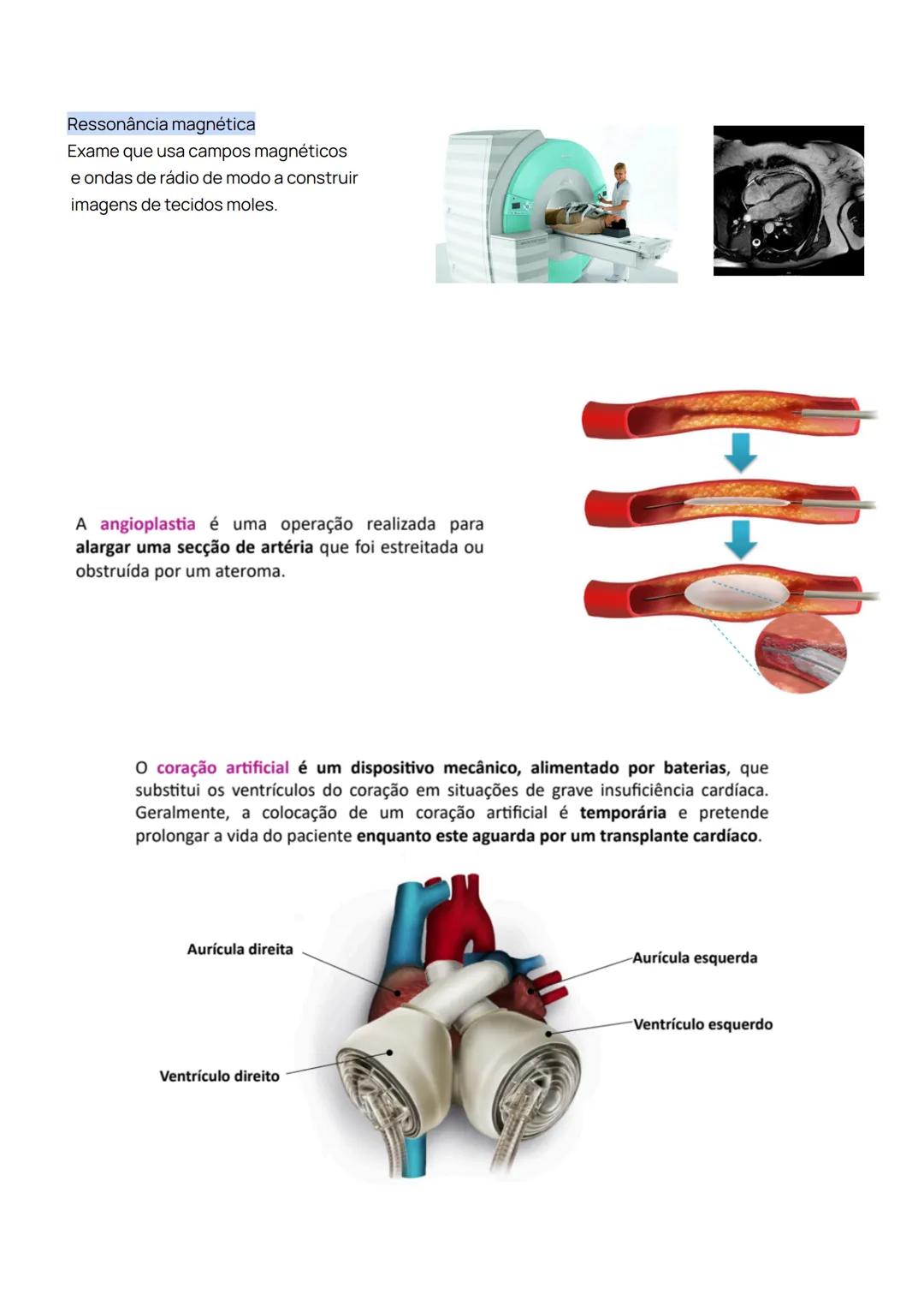 Sistema Cardiovascular
1. Identificar a constituição do sistema cardiovascular;
O sistema cardiovascular é composto pelo sangue, pelo coraç